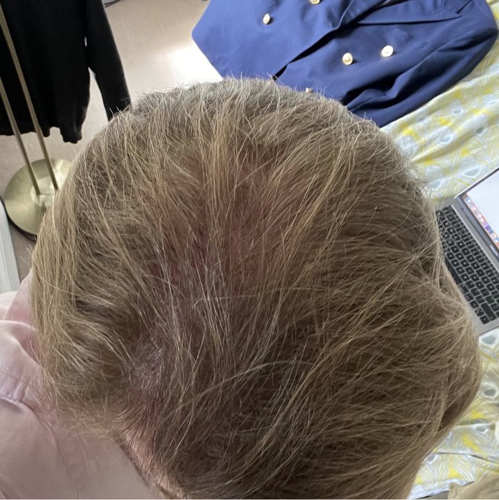 Customer hair after using SH1