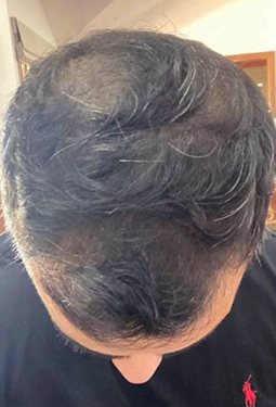 Customer hair before using SH1