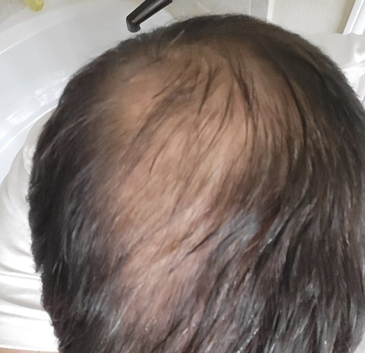 Customer hair before using SH1